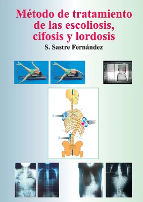 Método de tratamiento de las escoliosis, cifosis y lordosis Método de tratamiento de las escoliosis, cifosis y lordosis