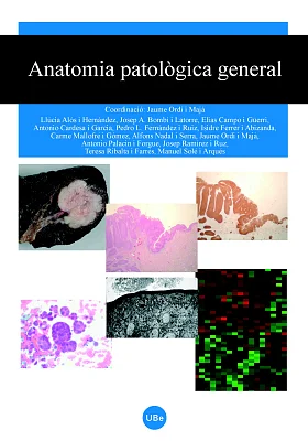 Anatomia patològica general Anatomia patològica general