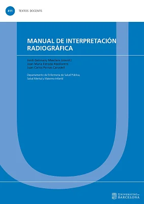 Manual de interpretación radiográfica (eBook) Manual de interpretación radiográfica (eBook)